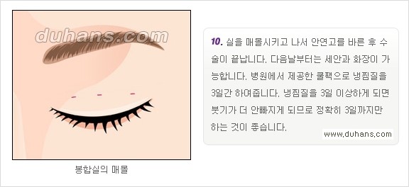​[두한성형외과 경쟁력 눈성형] - [자연스럽고 아름다운 쌍꺼풀의 기준] 관련 이미지 16