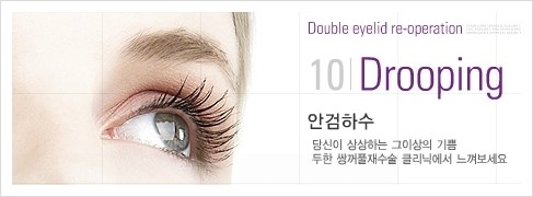 [두한성형외과 경쟁력 쌍꺼풀 재수술, 극한 눈재수술] - [안검하수 종류 안내] 관련 이미지 10