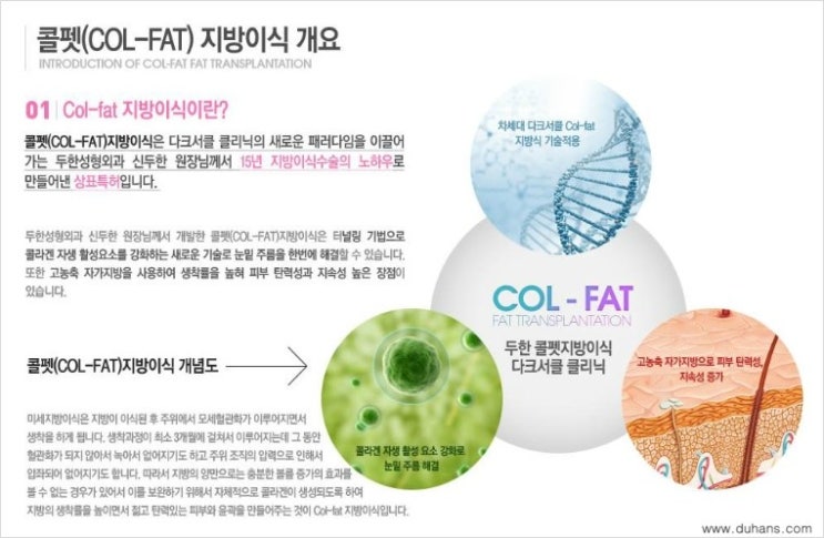 ​[두한성형외과 다크써클 치료] - [눈밑에 사선의 함몰주름선이 진하게 있는 다크써클 증상] 관련 이미지 4