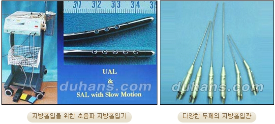 [두한성형외과 안전한 지방흡입] - [얼굴지방흡입] 관련 이미지 5