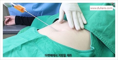[두한성형외과 경쟁력 멀티성형] - [다크써클 + 인디언밴드 콤비 프로그램 안내] 관련 이미지 3