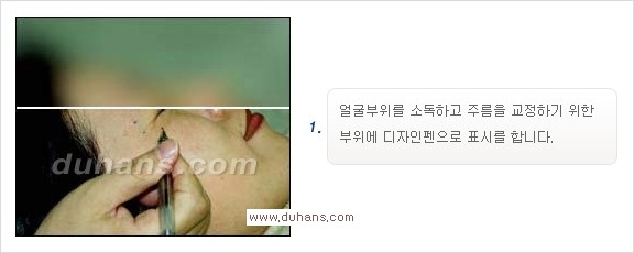 [두한성형외과 경쟁력 Quick 주름성형] - [주름교정을 위한 간편한 보톡스(보툴리눔톡신)] 관련 이미지 2