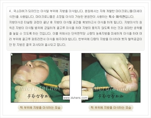 ⁠⁠[두한성형외과 경쟁력 미세지방이식] - [턱 미세지방이식 - 안면윤곽 교정 안내] 관련 이미지 10