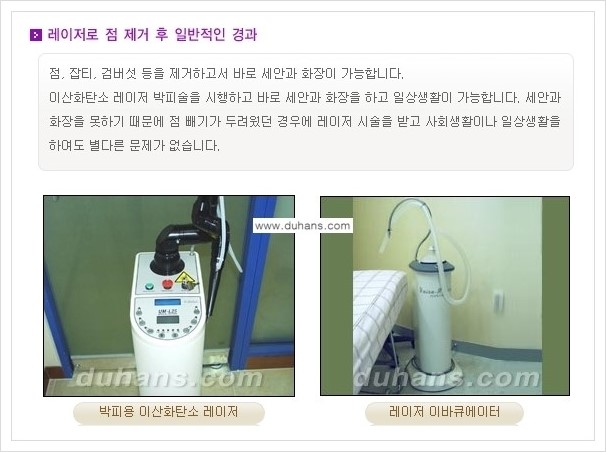 [두한성형외과 경쟁력 레이저시술] - [이산화탄소 점제거 안내] 관련 이미지 2