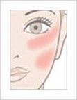 [두한성형외과 경쟁력 안전성형] - [최첨단 장비를 이용한 흉터, 점, 주근깨, 잡티, 문신제거 레이저 시술] 관련 이미지 6