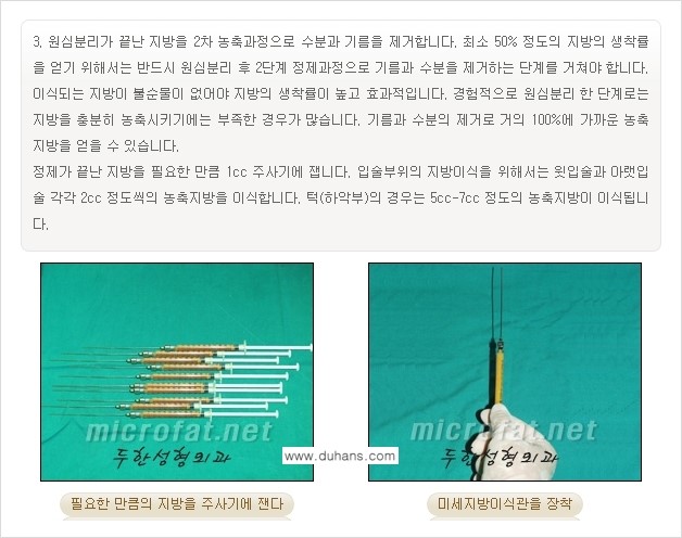 [두한성형외과 경쟁력 미세지방이식] - [얼굴 윤곽 무턱교정 안내 ②] 관련 이미지 4