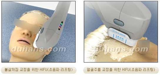 [두한성형외과 주름개선] - [주름교정 방법] 관련 이미지 13