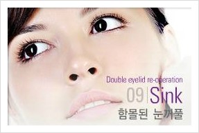 [두한성형외과 경쟁력 눈성형] - [극한 재수술, 함몰된 눈꺼풀 라인교정, 안검하수(졸리운 눈매)] 관련 이미지 31