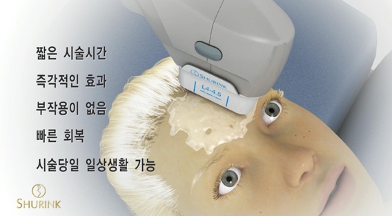 두한성형외과 주름개선 - 주름 HIFU 리프팅 관련 이미지 7