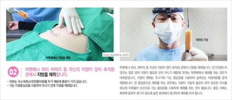[두한성형외과 경쟁력 눈밑성형] - [눈밑 다크써클 치료 - 다크써클 + 인디언밴드 콤비 프로그램] 관련 이미지 3