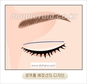 [두한성형외과 경쟁력 눈성형] - [자연스럽고 아름다운 눈매를 만드는 여러 가지 눈성형 방법] 관련 이미지 3