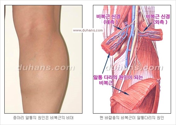 [두한성형외과 경쟁력 멀티 종아리성형] - [여러 가지 종아리 성형 방법의 단점 안내] 관련 이미지 5