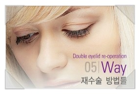 [두한성형외과 경쟁력 쌍꺼풀 재수술, 극한 재수술] - [풀려버린 쌍꺼풀 라인의 교정 방법 안내] 관련 이미지 1