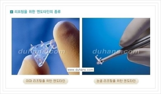 [두한성형외과 경쟁력 동안성형 리더] - ​[미간주름, 이마주름, 안검성형, 이마거상술, 눈썹거상술] 관련 이미지 40
