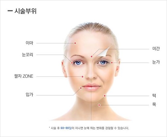 [두한성형외과 경쟁력 주름성형] - [주름제거를 위한 리프팅] 관련 이미지 30