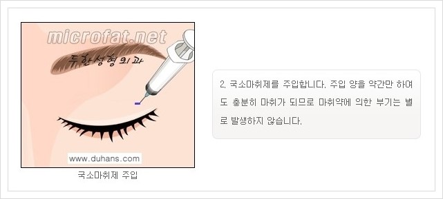 [두한성형외과 경쟁력 지방제거] - [눈 지방제거 안내] 관련 이미지 4