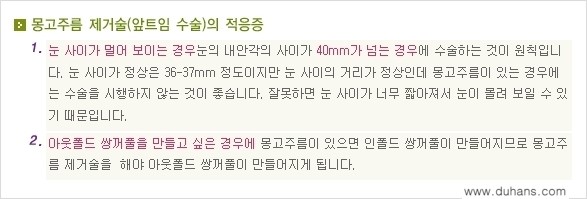 [두한성형외과 NO.1 눈성형] - [몽고주름 제거(앞트임 수술) 1.] 관련 이미지 6