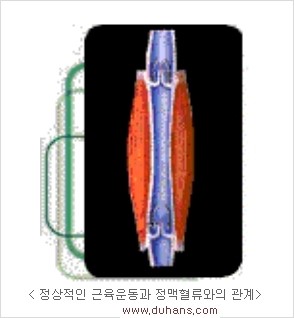 [두한성형외과 경쟁력 정맥류 치료] - [정맥류의 원인과 문제점, 정맥류 진단 방법] 관련 이미지 2