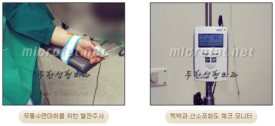 [Duhan Plastic Surgery Double Eyelid Revision Surgery] - [Correcting the Double Eyelid Line in Sunken Eyelids] image 53