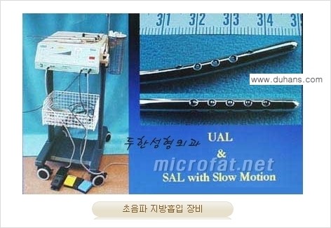 [두한성형외과 경쟁력 액취증, 다한증 치료] - [겨드랑이의 참기 힘든 냄새와 땀 치료 - 초음파 컷터지방흡입 + 리포셋 소파흡입술] 관련 이미지 1
