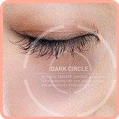 Duhan Plastic Surgery Dark Circle Improvement - What Causes Dark Circles? What Types of Dark Circles Are There? image 1