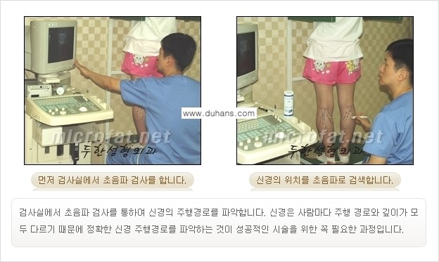 [두한성형외과 경쟁력 멀티종아리성형] - [초음파 유도 비절개 선택적 신경차단술의 효과] 관련 이미지 8