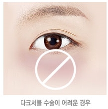 두한성형외과 눈밑수술 - 다크서클 수술 전후 관리 안내 관련 이미지 110