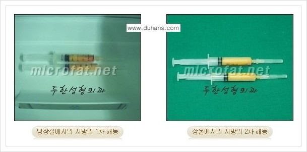 [두한성형외과 경쟁력 미세지방이식] - [두한 미세지방이식 클리닉의 특징 안내] 관련 이미지 19