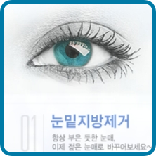 두한성형외과 눈밑성형 - 눈밑지방제거, 눈밑주름, 눈밑지방재배치 관련 이미지 1
