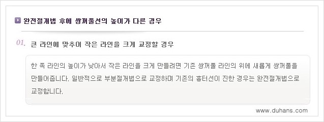 [두한성형외과 경쟁력 눈성형] - [짝짝이(비대칭) 쌍꺼풀 라인 교정하는 방법 안내 1.] 관련 이미지 4