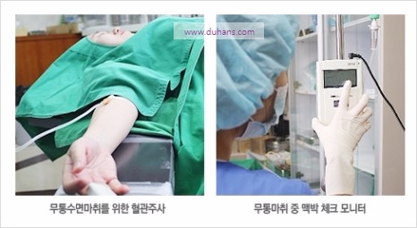 [두한성형외과 경쟁력 눈밑성형] - [하안검성형(눈밑주름제거술)에 의한 다크써클 교정] 관련 이미지 1