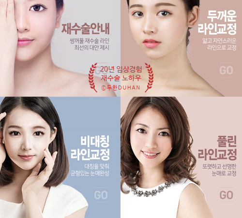 쌍커풀수술 두한성형외과 - 쌍꺼풀라인낮추기 관련 이미지 33