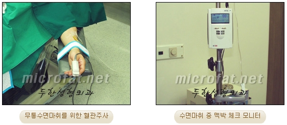 Fat Grafting Leader Duhan Plastic Surgery - Everything About Fat Grafting image 56