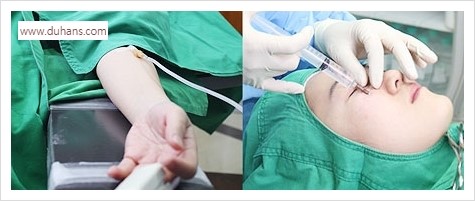 [두한성형외과 경쟁력 눈밑성형] - [눈밑 안와지방 돌출의 무통마취 무흉터 눈밑지방제거 안내] 관련 이미지 15