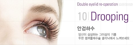 [두한성형외과 쌍꺼풀 재수술] - [안검하수 교정이 불가능할 경우의 문제] 관련 이미지 7