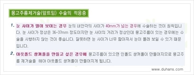 [두한성형외과 경쟁력 눈성형] - [흉터없는 몽고주름 제거 - 앞트임 수술 안내] 관련 이미지 5