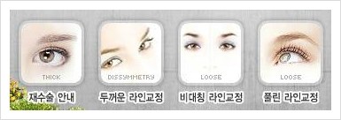 [두한성형외과 경쟁력 쌍꺼풀 재수술, 극한 재수술] - [망친 눈 복원 극한 재수술] 관련 이미지 7