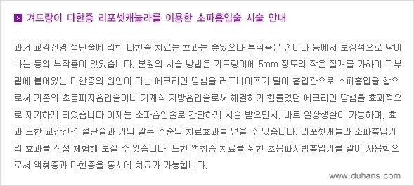 [두한성형외과 성형 FOCUS 지방흡입] - [액취증 - 다한증 초음파 컷터 지방흡입 ⑤] 관련 이미지 3