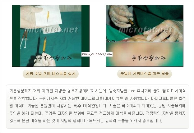 [두한성형외과 경쟁력 눈밑성형] - [눈밑 애교살 - 이상적인 눈밑 미세지방이식 방법] 관련 이미지 6