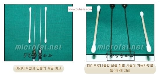 [두한성형외과 경쟁력 귀족성형] - [3차원 입체 미세지방이식 귀족수술 + 인디언밴드 교정] 관련 이미지 35
