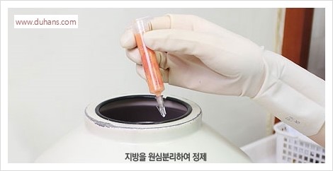 [두한성형외과 경쟁력 멀티성형] - [다크써클 + 인디언밴드 콤비 프로그램 안내] 관련 이미지 5