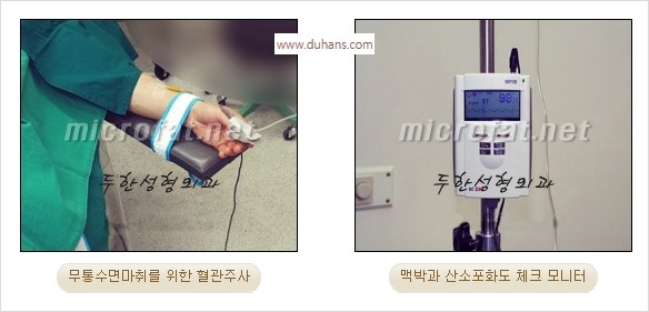 [두한성형외과 경쟁력 안면윤곽 교정] - [자연스럽고 균형있는 턱으로의 복원 미세지방이식과 간편 사각턱 보톡스 안내] 관련 이미지 27