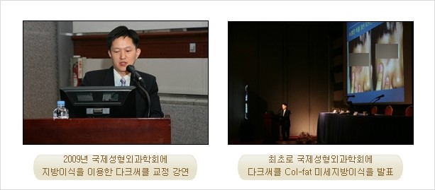 [두한성형외과 경쟁력 눈밑성형] - [Dr. 컬럼 - 눈밑 다크써클의 치료 방법과 치료 효과] 관련 이미지 17