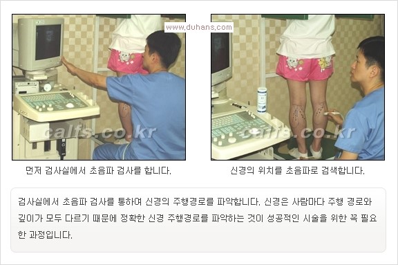 [두한성형외과 경쟁력 멀티종아리성형] -  [종아리 축소술의 여러 가지 종류] 관련 이미지 11