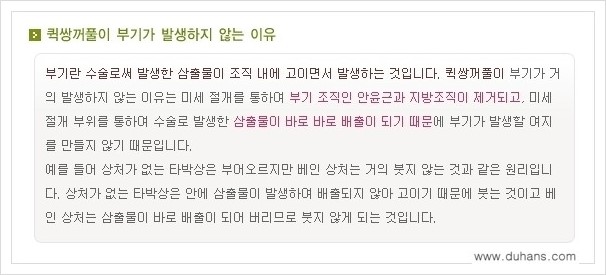 [두한성형외과 경쟁력 눈성형] - [퀵쌍꺼풀 안내] 관련 이미지 1