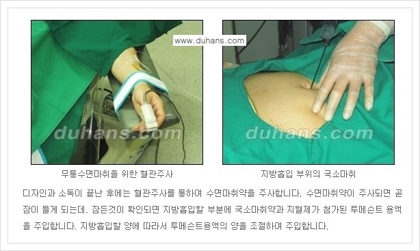 [두한성형외과 경쟁력 초음파 간편지방흡입] - [복부지방흡입, 허벅지지방흡입, 엉덩이지방흡입, 팔뚝지방흡입 안내] 관련 이미지 11
