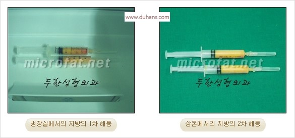 [두한성형외과 경쟁력 안면윤곽 교정] - [자연스럽고 균형있는 턱으로의 복원 미세지방이식과 간편 사각턱 보톡스 안내] 관련 이미지 38