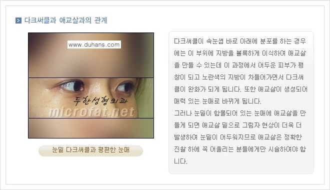 [두한성형외과 경쟁력 눈밑성형] - [눈밑 애교살 시술 안내 1.] 관련 이미지 2