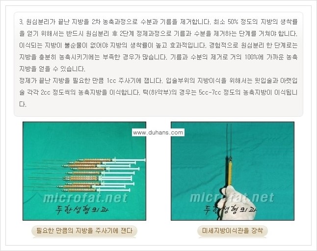 [두한성형외과의 경쟁력 미세지방이식] - [무턱교정, 턱 미세지방이식 안내 1.] 관련 이미지 10