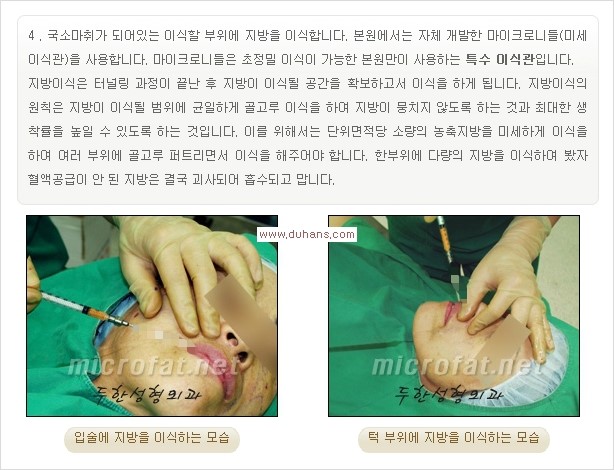 [두한성형외과 경쟁력 미세지방이식] - [입술 3차원 입체지방이식 안내 1.] 관련 이미지 7